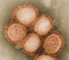 H1N1-influensavirus. Foto: Goldsmith and Balish, US Public Health Image Library