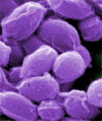 mjältbrandsbakterie, Foto Laura Rose, US Public Health Image Library